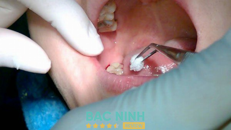 Nha khoa Quốc tế Việt Hàn Thuận Thành