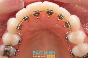 Nha Khoa Tuyến Hiển - hình ảnh 1